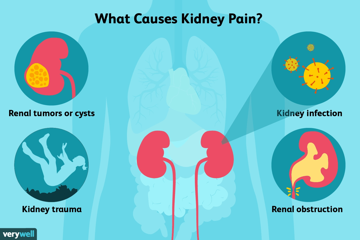 How to Identify Kidney Pain ?